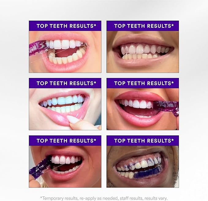 Hismile V34 Whitening Strips, Teeth Whitening Strips